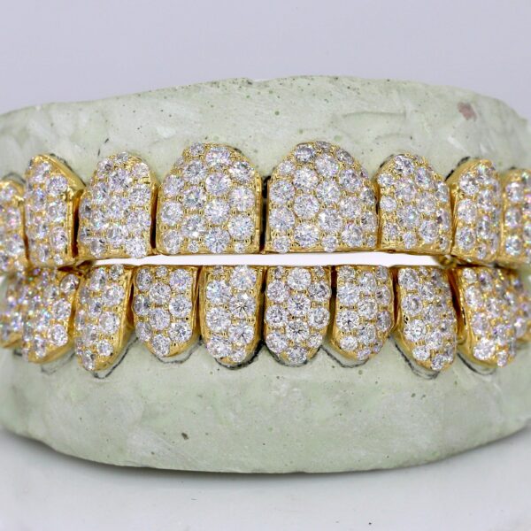 Jumbo VVS Moissanite Diamond Grillz