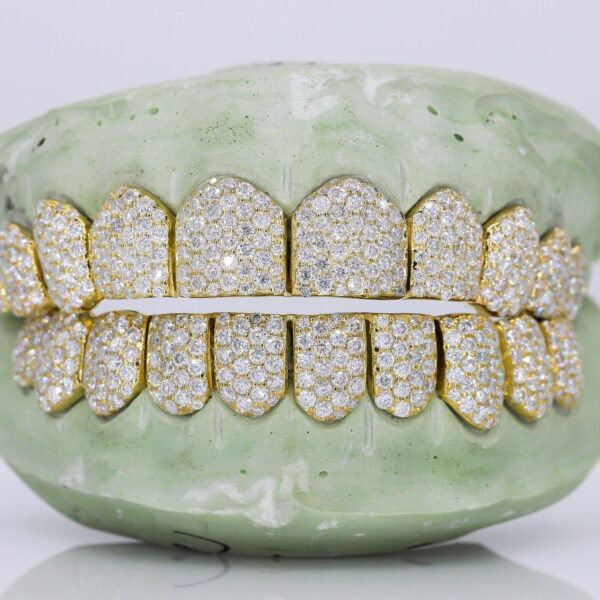 10 on 10 VVS Moisannite Diamond Grillz