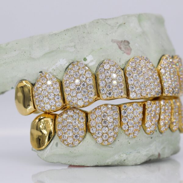 10 on 10 Capped VVS Moisannite Diamond Grillz