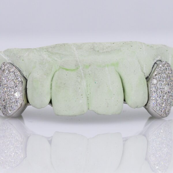 Diamond Fangs VVS Moissanite Diamond Grillz
