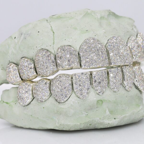 VVS Lab Diamond Grillz