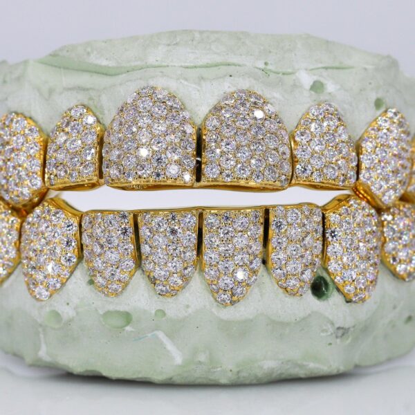 8 on 8 VVS Moissanite Diamond Grillz