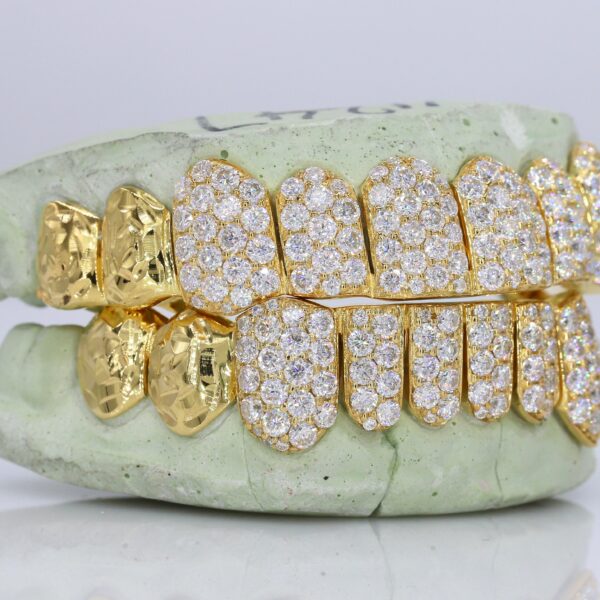 10 on 10 Jumbo Double Rose Cut Cap VVS Moissanite Diamond Grillz