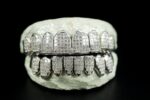 Iced-Out Diamond Grillz Set White Gold Finish