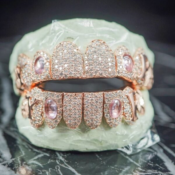 Louis Vuitton Iced-Out Rose Gold Designer Grillz Set