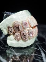 Louis Vuitton Iced-Out Rose Gold Designer Grillz Set - Image 2