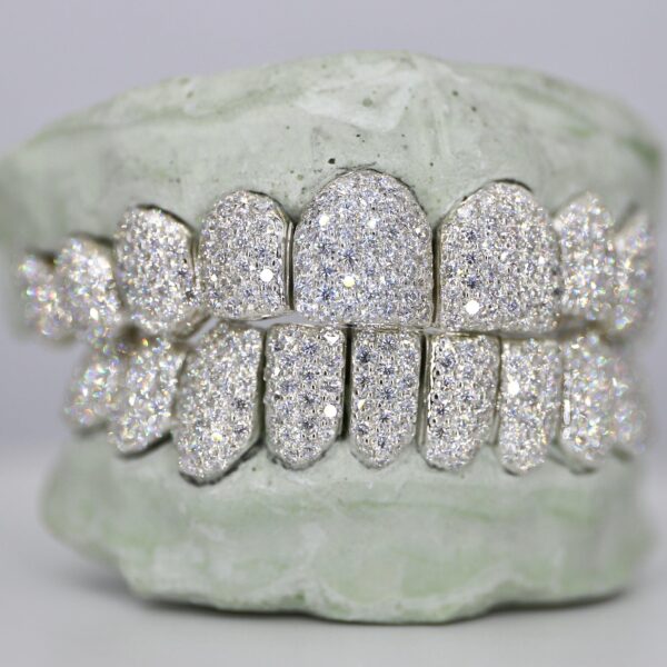 Customizable VVS Moissanite Diamond Grillz