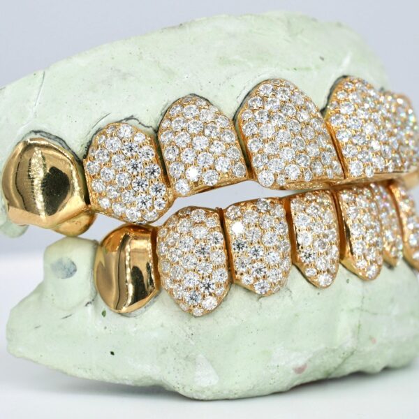 8 on 8 Capped VVS Moissanite Diamond Grillz