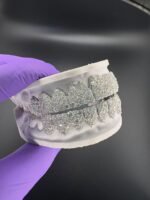 Luxury Iced Out Moissanite Grillz Set - Image 2