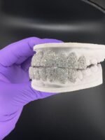 Luxury Iced Out Moissanite Grillz Set - Image 4