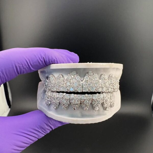 Luxury Iced Out Moissanite Grillz Set